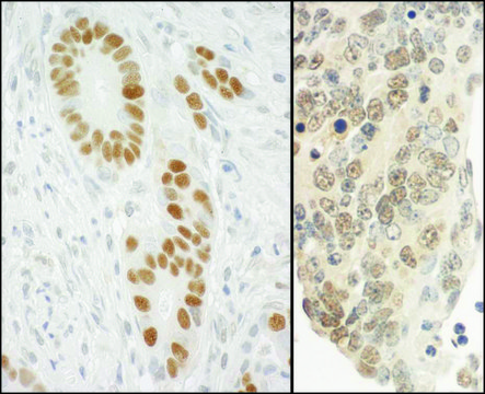 Rabbit anti-PCNA Antibody, Affinity Purified Powered by Bethyl Laboratories, Inc.