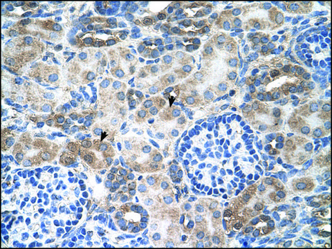 Anti-SLC14A1 antibody produced in rabbit affinity isolated antibody