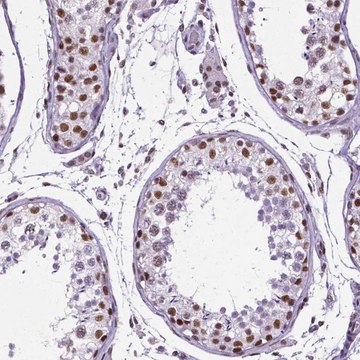 Monoclonal Anti-REST antibody produced in mouse Prestige Antibodies&#174; Powered by Atlas Antibodies, clone CL0381, purified immunoglobulin, buffered aqueous glycerol solution