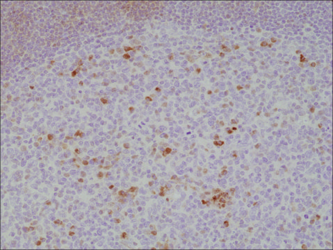 Anti-OX40 (CD134) antibody, Rabbit monoclonal recombinant, expressed in HEK 293 cells, clone RM313, purified immunoglobulin