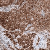 Anti-GSPT1 antibody produced in mouse Prestige Antibodies® Powered by Atlas Antibodies, clone CL13336, purified by using Protein A, buffered aqueous glycerol solution