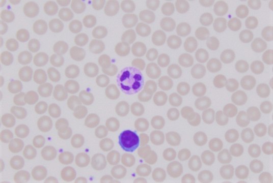 Giemsa Stain, Modified