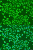 Anti-ACOX1 antibody produced in rabbit