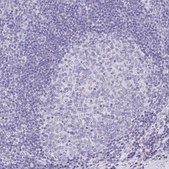 Anti-ANXA10 antibody produced in rabbit Prestige Antibodies® Powered by Atlas Antibodies, affinity isolated antibody, buffered aqueous glycerol solution