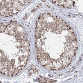 Anti-TRMT10C antibody produced in rabbit Prestige Antibodies® Powered by Atlas Antibodies, affinity isolated antibody, buffered aqueous glycerol solution