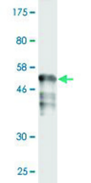 Monoclonal Anti-RAD51 antibody produced in mouse clone 4C11-B4, purified immunoglobulin, buffered aqueous solution