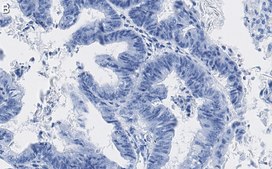 Anti-p-4E-BP1 (Thr37/46) Antibody, clone 1N7 ZooMAb® Rabbit Monoclonal recombinant, expressed in HEK 293 cells