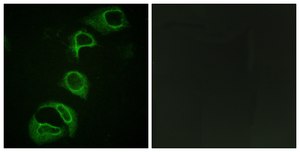 Anti-ALK (Phospho-TYR1604) affinity isolated antibody