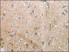Anti-XKR4 affinity isolated antibody