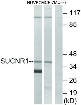 Anti-SUCNR1 antibody produced in rabbit affinity isolated antibody