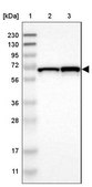 Anti-DENND4C antibody produced in rabbit Prestige Antibodies® Powered by Atlas Antibodies, affinity isolated antibody, buffered aqueous glycerol solution