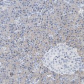 Anti-ADHFE1 antibody produced in rabbit Prestige Antibodies® Powered by Atlas Antibodies, affinity isolated antibody, buffered aqueous glycerol solution