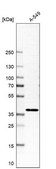 Anti-MFSD5 antibody produced in rabbit Prestige Antibodies® Powered by Atlas Antibodies, affinity isolated antibody, buffered aqueous glycerol solution