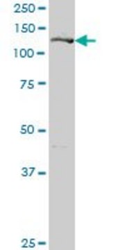 Anti-GIT2 antibody produced in mouse purified immunoglobulin, buffered aqueous solution