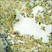 抗-磷酸化-Tau (pSer356) 兔抗 affinity isolated antibody