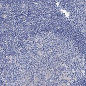 Anti-DYDC2 antibody produced in rabbit Prestige Antibodies® Powered by Atlas Antibodies, affinity isolated antibody, buffered aqueous glycerol solution