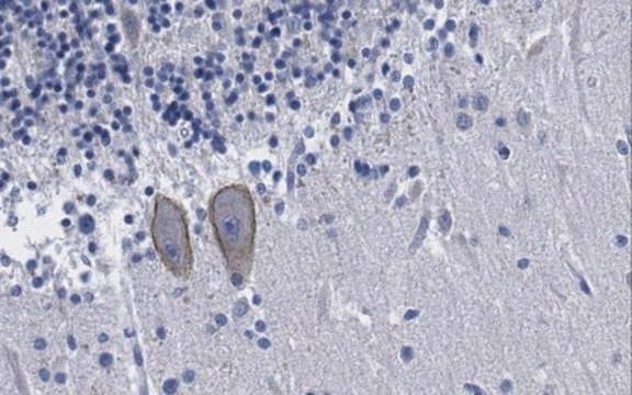 Anti-Neuregulin-2 Antibody (NRG2), clone 8D11 clone 8D11, from mouse