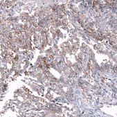 Anti-CD99 antibody produced in mouse Prestige Antibodies® Powered by Atlas Antibodies, clone CL12929, purified by using Protein A, buffered aqueous glycerol solution