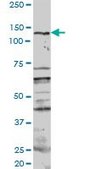 Anti-PKN1 antibody produced in rabbit purified immunoglobulin, buffered aqueous solution