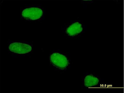 Anti-CENPV antibody produced in mouse purified immunoglobulin, buffered aqueous solution