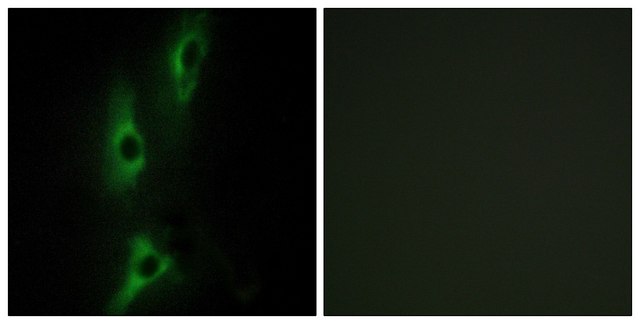 Anti-ADRB2 antibody produced in rabbit affinity isolated antibody