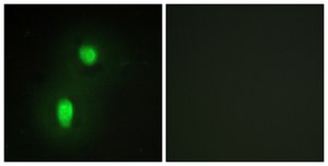 Anti-HNRNP C1 antibody produced in rabbit affinity isolated antibody