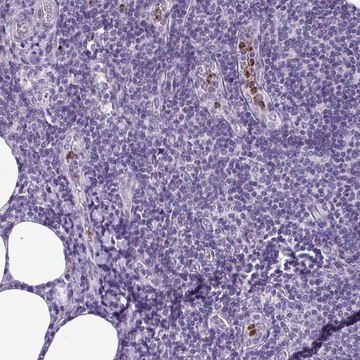 Anti-TMEM11 antibody produced in rabbit Prestige Antibodies&#174; Powered by Atlas Antibodies, affinity isolated antibody, buffered aqueous glycerol solution