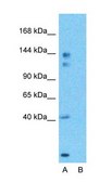 Anti-CUX2 affinity isolated antibody