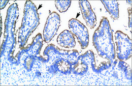 Anti-TRIM15 antibody produced in rabbit IgG fraction of antiserum