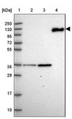 Anti-C6 antibody produced in rabbit Prestige Antibodies® Powered by Atlas Antibodies, affinity isolated antibody, buffered aqueous glycerol solution