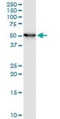 Monoclonal Anti-ENO1 antibody produced in mouse clone 3C8, purified immunoglobulin, buffered aqueous solution