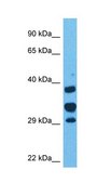 Anti-ANP32E antibody produced in rabbit affinity isolated antibody
