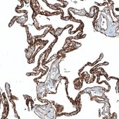 Monoclonal Anti-ITGA3 antibody produced in mouse Prestige Antibodies® Powered by Atlas Antibodies, clone CL6937, purified immunoglobulin, buffered aqueous glycerol solution