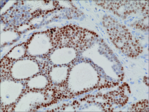 Anti-PR (Progesterone Receptor) antibody, Rabbit monoclonal recombinant, expressed in HEK 293 cells, clone RM357, purified immunoglobulin