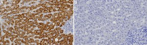 Anti-TAOK2 Antibody, clone 1N9 ZooMAb® Rabbit Monoclonal recombinant, expressed in HEK 293 cells