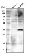 Anti-GATAD1 antibody produced in rabbit Prestige Antibodies® Powered by Atlas Antibodies, affinity isolated antibody, buffered aqueous glycerol solution