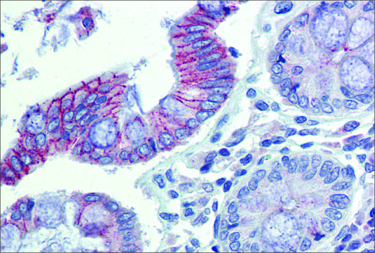 Anti-DSG2 antibody produced in rabbit affinity isolated antibody