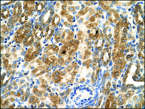 Anti-MAS1 (AB2) antibody produced in rabbit IgG fraction of antiserum