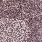 Anti-RARG antibody produced in rabbit Prestige Antibodies® Powered by Atlas Antibodies, affinity isolated antibody, buffered aqueous glycerol solution