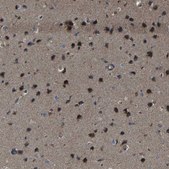 Anti-SNN antibody produced in rabbit Prestige Antibodies® Powered by Atlas Antibodies, affinity isolated antibody, buffered aqueous glycerol solution