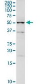 Anti-UGP2 antibody produced in rabbit purified immunoglobulin, buffered aqueous solution