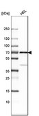 Anti-SH2B3 antibody produced in rabbit Prestige Antibodies® Powered by Atlas Antibodies, affinity isolated antibody, buffered aqueous glycerol solution