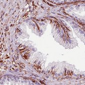 Monoclonal Anti-VIM antibody produced in mouse Prestige Antibodies&#174; Powered by Atlas Antibodies, clone CL0157, purified immunoglobulin, buffered aqueous glycerol solution