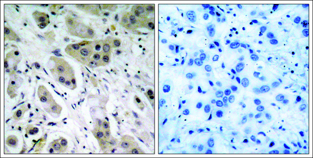 Anti-phospho-AKT1 (pSer473) antibody produced in rabbit affinity isolated antibody