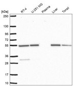 Anti-SMYD3 antibody produced in rabbit Prestige Antibodies® Powered by Atlas Antibodies, affinity isolated antibody