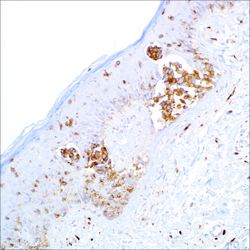 CD63 (NKI/C3) Mouse Monoclonal Antibody