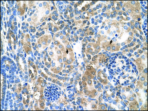 Anti-NR3C2 antibody produced in rabbit IgG fraction of antiserum