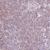 Anti-RRS1 antibody produced in rabbit Prestige Antibodies® Powered by Atlas Antibodies, affinity isolated antibody, buffered aqueous glycerol solution