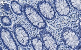 Anti-LSD1 Antibody, clone 1O8 ZooMAb® Rabbit Monoclonal recombinant, expressed in HEK 293 cells