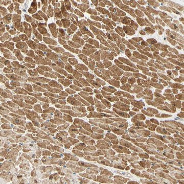 Anti-ADAM17 antibody produced in rabbit Prestige Antibodies&#174; Powered by Atlas Antibodies, affinity isolated antibody, buffered aqueous glycerol solution